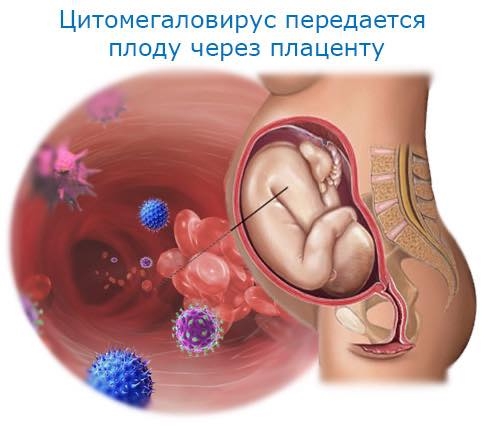 ЖИРЭМСЛЭЛТ БА ШЭЭС БЭЛГИЙН ЗАМЫН ХАЛДВАР  /НӨАГ-ын Эх барих эмэгтэйчүүдийн эмч, Анагаах ухааны доктор, Клиникийн профессор, Зөвлөх зэргийн эмч Ш.Цэрэнсамбуу/