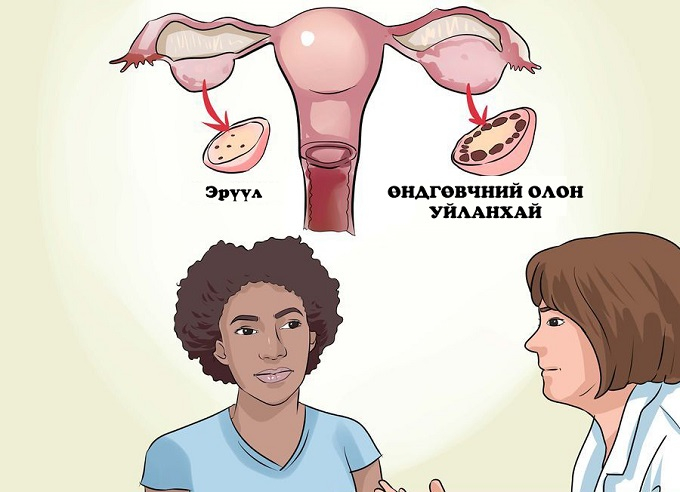 ӨНДГӨВЧНИЙ ОЛОН УЙЛАНХАЙТ ХАМШИНЖ ГЭЖ ЮУ ВЭ?