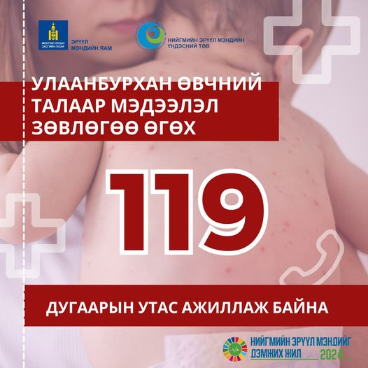 Улаанбурхан өвчнөөс урьдчилан сэргийлцгээе!